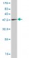 CFL1 Antibody (monoclonal) (M04)